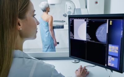 Radiografía del Cáncer de Mama en el mundo