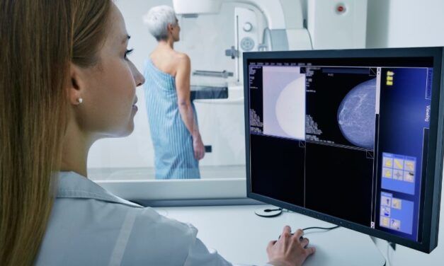 Radiografía del Cáncer de Mama en el mundo