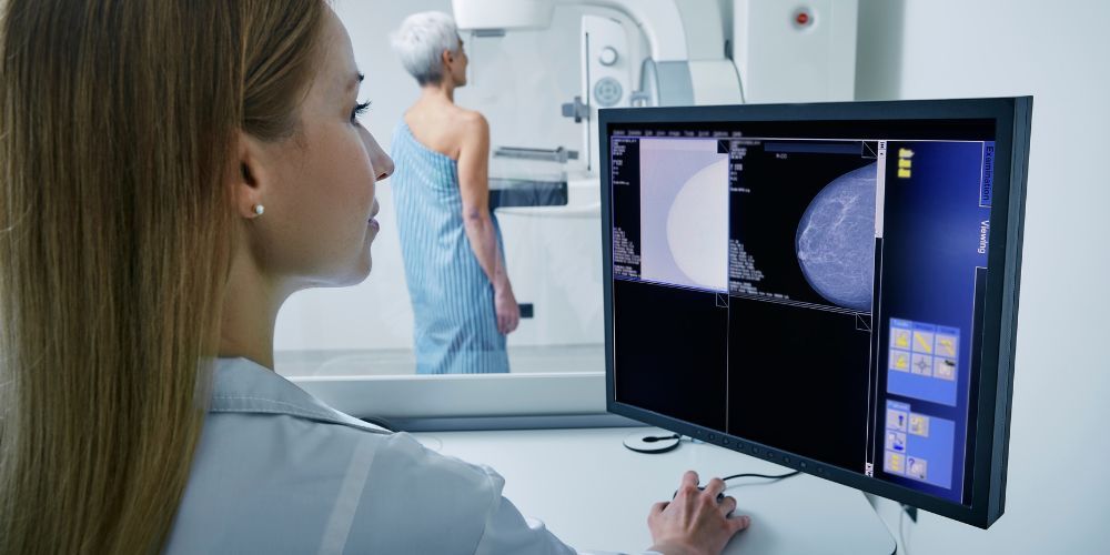 Radiografía del Cáncer de Mama en el mundo
